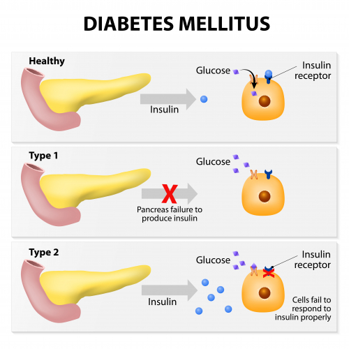 Image of pancreas and insulin effects on glucose